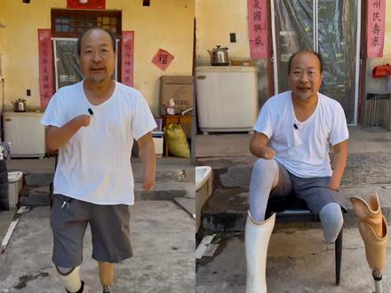 文言文自传,曾经风靡于网络的介绍自己的文字游戏,还有人玩吗? 文言小传
鄙人索罗森也,七二年生,生即无双手,无左小腿,亦无右脚。苦哉!八岁前如猫狗伏地而爬,八岁始扶双拐学站立,九岁能拄单拐而行走。少年懵懂,学业未精;青年鲁钝,诸事乖舛。虽恃单拐撑残躯,然形同枯木,面如僵尸,终年困顿于蓬蒿之间也。二十九岁,见他人义肢,然囊中羞涩无力购之。父悯,斫树根,锤铁皮,裁钢板,焊螺杆,为吾仿制之。幸哉,年近三十,终得弃拐杖、戴假肢,如婴孩之蹒跚学步尔。今五十有三,方能走出家门窥世一斑。可谓晚乎?诚为晚矣!然尚觉桑榆非晚,终不肯自弃,犹奋起直追,图白首青云、大器晚成也! #励志老索爱书法 #文言文自传 #如何走出人生低谷 #正能量视频 #励志正能量