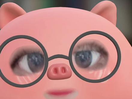 一栗小莎子三期化疗 我作为有能力的人,聊聊淋巴瘤治疗
小姑娘拎不清
救人一命胜造七级浮屠。不要把健康当儿戏
学习重要性 #girlstalk #浙江 霍奇金淋巴瘤 住院 温州瑞安市 安徽滁州 江浙沪 已婚妇女 宝妈 #健康 病例 上海 三甲医院 放疗 靶向治疗 术后 手术 豪斯医生 骨髓穿刺 杭州 绍兴 宁波 北上广 生孩子 怀孕 备孕 促排 中药 中医 癌症预防 常识科普 西医 pet-CT cart #女性成长 #全球创作者计划 女性智慧 冷知识 结婚 女生必看 网红博主 教育 医疗资源 看病 原生家庭 体检 甲状腺 乳腺 夫妻 成功治愈 经验分享
龙飞律师