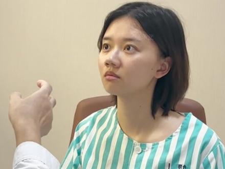 只是做了个鼻子 #隆鼻 #变美 #大鼻头 #蒜头鼻 #鼻翼缩小