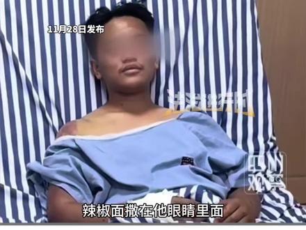 中国“网红”在非洲遭中国博主绑架虐待 因拒绝参与诈骗国内同胞的活动 被非法拘禁七天 手脚被打断(编辑:刘洋)