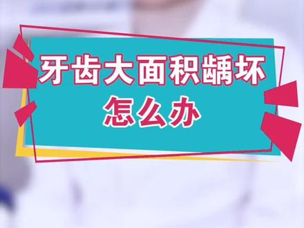 牙齿大面积龋坏,该怎么办呢?#创作人计划 #郑州 @抖音小助手