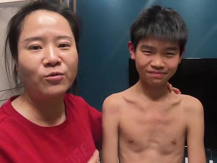 大家帮我看看,我儿子是不是马凡,是不是鸡胸?#日常生活 #鸡胸