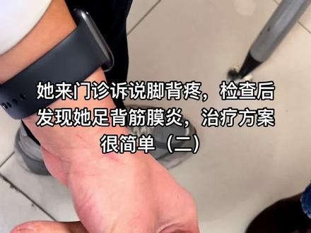 #医学科普 #足背 #筋膜炎 #脚背疼 #足背疼 #暴走族 #适当运动 @aico