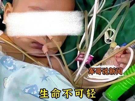 生命不可轻!四问宁波女婴手术悲剧 五月龄女婴小洛熙在宁波大学附属妇女儿童医院心脏手术后离世的悲剧,不仅让亲人陷入无尽悲痛,更引发了公众对婴幼儿医疗安全、医患沟通边界与医疗监管效能的深度追问。
从术前评估到术中处置,从信息公开到纠纷处理,这个事件中的诸多疑点,亟待一场彻底、透明的调查给出答案。因为每个生命即便再幼小都值得被敬畏,每一次医疗决策都应慎之又慎。
从目前已披露的情况来看,医患之间核心争议集中在四个方面:
一、立即手术是否必要存疑?医学共识显示,多数5月龄婴儿的小型房间隔缺损(3mm+7mm)处于自愈窗口期,且患儿术前生长发育正常、无明显症状,并非紧急手术指征。但涉事医生将其描述为“必须立即做”的高风险手术,与常规医学建议存在明显偏差。术前未充分告知家属“观察等待”的替代方案,反而夸大手术紧迫性与低风险,剥夺了家属的理性选择权,涉嫌过度医疗倾向。
二、术中知情权是否被侵犯?手术因首次缝合效果不佳被迫二次修补,时长从预估2.5-3小时延长至7小时10分钟,如此重大变故,院方未及时告知家属,也未获得二次知情同意,既违背了《医疗纠纷预防和处理条例》中关于诊疗重大变化需及时沟通的要求,也违背医疗伦理。
三、病历与视频是否存疑?死亡通知书记录的22点03分死亡时间,与病历中“22 点20分生命体征平稳”的记载相互矛盾;家属依法要求查阅手术室及ICU视频遭拒,而相关视频若记录诊疗过程,应属病历资料范畴,医院无正当理由拒绝涉嫌违规。
四、医生监管是否存在漏洞?涉事医生此前已涉及两例低龄婴儿手术死亡事件,却未被暂停执业或严格评估,暴露出医疗机构对高风险医生的监督问责机制可能存在短板。
这些疑点的存在势必加剧医患双方的不信任,当下宁波市卫健委的介入调查,异地尸检结果报告出来还需一段时间。我们相信最终的调查报告会对这些疑点逐一回应,既不让失职者免责,也不纵容非理性追责。
这起悲剧不仅是一个家庭的伤痛,更是完善医疗管理制度的契机。唯有以真相告慰逝者、以制度防范风险、以公正回应关切,才能重建医患信任,避免类似悲剧重演。#军哥说新闻 #四问宁波女婴手术悲剧 @抖音创作小助手 @抖音 @抖音小助手