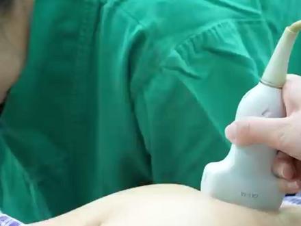 子宫肌瘤超过5公分必须切除? #子宫肌瘤 #医学科普 #余松远医生 #微创