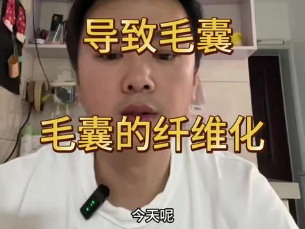 头皮的硬度导致毛囊毛囊纤维化 #真实生活分享计划 #脱发 #脂溢性皮炎 #头皮屑 #毛囊炎