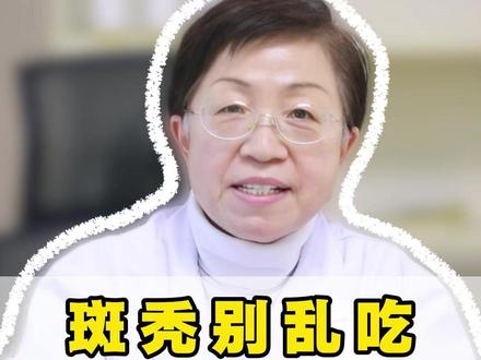 斑秃别乱吃这三种食物,越吃掉的越厉害 #宋佩华#中医#脱发#北京dou知道#斑秃