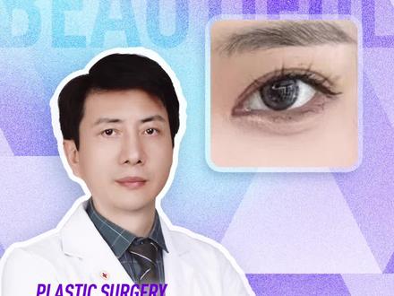 双眼皮分叉是怎么回事? #双眼皮手术 #双眼皮修复