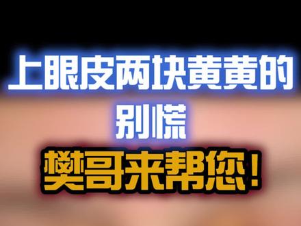 上眼睑两块黄黄的原来是它!注意清淡饮食 #樊哥撩皮肤 #睑黄瘤 #医学科普