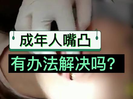 你的嘴凸做牙齿矫正有用吗?
#正畸 #整牙 #隐形矫正