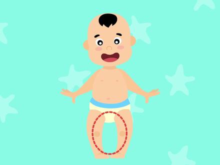 罗圈腿又叫#O型腿 ,学会辨别,了解成因,才能更好预防!#母婴 #生长发育 #育儿