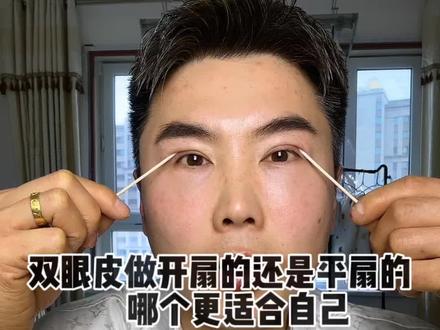 do双眼皮做开扇的还是平扇的?哪个更适合自己?教程来喽#埋线双眼皮修复 #双眼皮 #开扇型双眼皮 #平扇形双眼皮 #长春