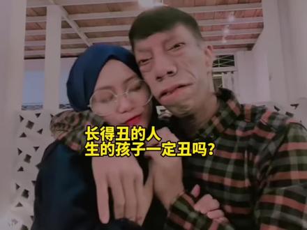 找一个长得丑的老公,剩下来的孩子就一定会很丑吗 #颜值 #遗传 #长相
