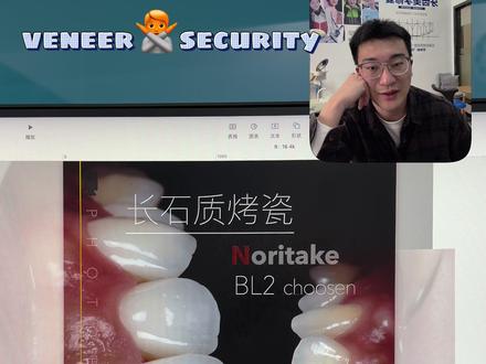 关于长石质烤瓷 要了解每个材料的粘接原理,呈现效果,不同的适应症,配合技师老师一起完成好的修复作品。总结后再去根据自己的喜好特长近一步把材料的优势优点放大。#每日分享 #牙医日常 #手工瓷贴面 #美学修复 #我就这样开启2026