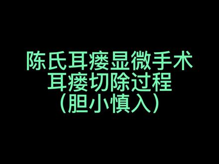 陈氏耳瘘显微手术耳瘘切除过程。胆小慎入!!!#耳前瘘管 #陈氏耳瘘手术 #手术室你不知道的事