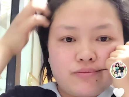 自己亲手拔牙的后续来了朋友有们#等等我先摆好造型 #憋住不准笑