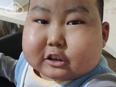 10岁白血病患者“豪豪"离世 4岁确诊曾经历17次化疗2次骨髓移植家属悲痛发文:他再也不用打针吃药再也不会痛了此前许愿“王子请恢复健康 永不复发”引发全网关注#豪豪 #白血病