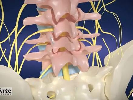 针刀治疗3D动画视频