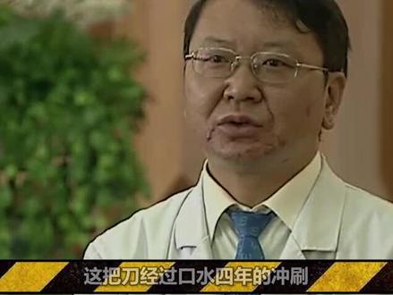 大哥脑袋里插着一把水果刀 活了四年!#走近科学 #爆笑解说