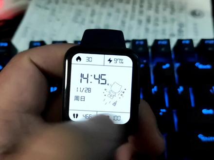 红米手表2仅购买五天就触摸失灵,售后会怎么处理?