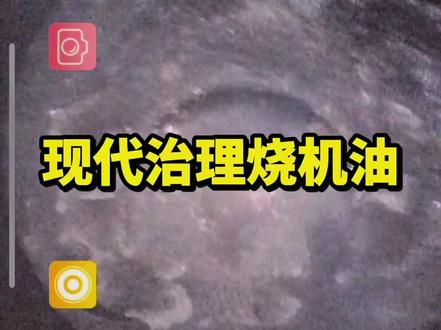现代领动烧机油治理#德州 #免拆治理烧机油