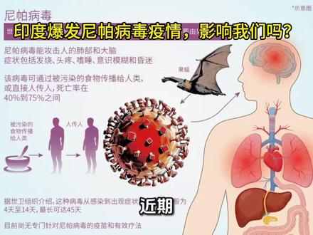 印度暴发尼帕病毒病疫情,对我们影响大吗?#尼帕病毒 #尼帕病毒是什么 #印度尼帕病毒 #疫情 #涨知识