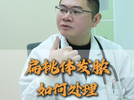 扁桃体发脓如何处理? #扁桃体发炎化脓 #儿科门诊 #儿科医生 #儿童健康