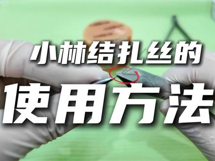 正畸中小林结扎丝的使用方法,小林结扎丝它是一根成品的长的0.3的结扎丝。我们首先拿出来一根之后,它上端会有一根弯制好的曲,那后面的长出来的直丝呢我们可以自己去弯一个这样的牵引钩。我们可以首先剪下来一个位置,然后我们可以使用持针器把夹住中间的位置,大概夹住一两个毫米就可以,夹紧之后把丝向上这样弯置,然后用左手拿住这个持针器,我们可以找一把钳子细丝弯针钳或者转矩钳都可以,我们夹到大概我们需要牵引钩的长度,大概是3个毫米到4个毫米左右夹紧之后,然后转动左手的试针器,这样我们就会得到一个自制的牵引钩,那我们可以稍微把钩子的下端稍微打开一点,这样这个牵引钩就做好了
这个时候我们可以就把它绑到托槽的上面把它的两端绑到托槽的近远中从弓丝下面穿过,然后固定好牵引钩的位置然后向口外的方向去这样夹紧,然后这个时候使用持针器夹住,然后固定住这个牵引钩的位置避免它乱动,然后这个时候再去拧紧,再去拧紧这个结扎丝然后再把末端长出的给它剪掉,然后这时我们把织出来这个藏到织出来的结扎丝藏到弓丝的下面,然后我们再调整一下钩子的位置,这样这个弯制的嵌眼钩就做好了。
#正畸 #固定矫治 #正畸工具 #弓丝 #牙医