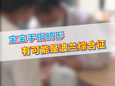 宝宝是波兰综合征,手指短小并在一起,胸大肌胸小肌缺失发育不好,造成胸口凹陷,现在宝宝还太小,达不到治疗的条件