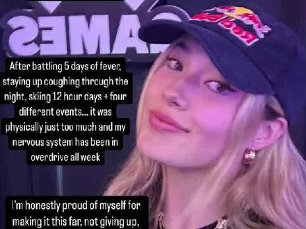 冬奥冠军谷爱凌曾因训练摔倒导致脑出血