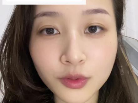 发的视频出现视频画面或网络问题的解决办法#自媒体