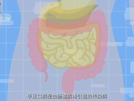 现在手足口病进入高发期,这份放控指南请收好!#科普 #涨知识 #健康 @抖音小助手