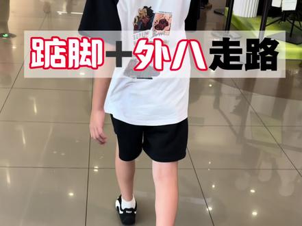 踮脚走路,必定小腿外翻➕小腿粗壮
#踮脚走路#高足弓#足内翻#小腿外翻 #鱼余直腿