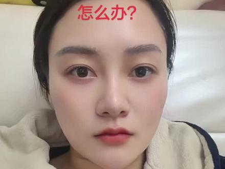 打完替尔泊肽后胃口大开怎么办?#打针减肥