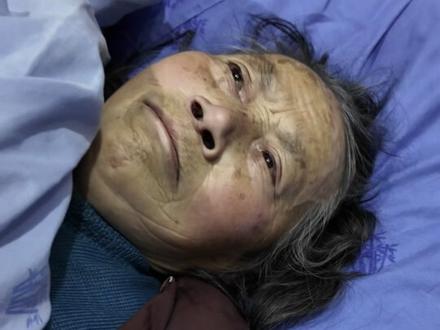 检查结果出来了,姑婆是粉碎性骨折,需要尽快手术治疗,帽子叔叔已经调取了现场监控,推姑婆的人也找到了,但是对方说拿不出这么多钱来,后续还在跟进处理中,谢谢大家的关心。