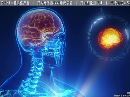 #脑梗 复发的4大真相,避开就能少遭罪!药+健康生活方式双管齐下。#用药安全
#健康生活方式 #抖出健康知识宝藏 #医学科普