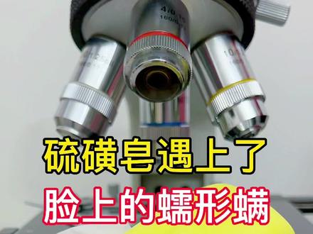 脸上的#蠕形螨 遇到了硫磺皂,结果有点意外。#创作灵感 #螨虫别想逃