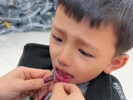 孩子新牙长出来老牙还没掉,在网上学的猪鼻扣打结方法我自己在家给孩子拔牙,省事省qian孩子也不用去医院看到医生害怕,家里有快掉牙的宝妈们可以学起来!我手很笨都能学会!