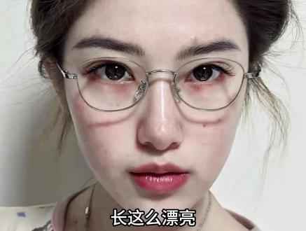 姐这么美都是应得的#变美#素颜#原相机#颜值#补铁