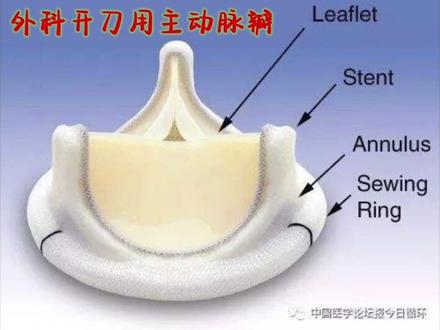这是什么?“奔驰”标?这就是传说中的人工生物瓣膜!
#人工瓣膜 #心脏瓣膜 #医生 #心脏 #心外科柳叶刀