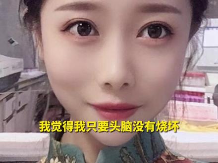 4月3日,四川峨眉山,#对话烧伤928天后重生女孩乔燕 :对未来很憧憬,想学配音,想带家人旅游。#23岁女孩烧伤928天后重生