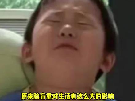 脸盲症逛街遇到熟人有多尴尬#万万没想到 #娱乐评论大赏