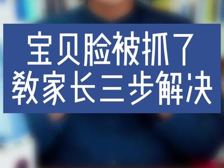 学家庭教育成为会教育孩子的父母。孩子在幼儿园被小朋友抓破了脸,该怎么处理?给家长三招解决。#家庭教育 #父母课堂 #家长 @DOU+小助手
