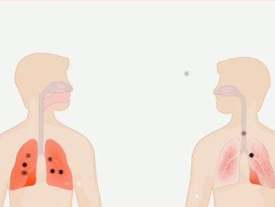 网红沐言确诊合胞病毒#沐言