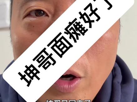 坤哥面瘫一个月就好了#面瘫#面瘫患者 #面瘫一般多久恢复正常