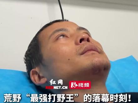 荒野“最强打野王”的落幕时刻!12月2日 湖南张家界七星山荒野求生决赛第9天,“刀疤哥”体检时眼含泪水,本人回应退赛原因:肠胃出现不适,经过医生的建议 下山了。#决战张家界七星山荒野求生