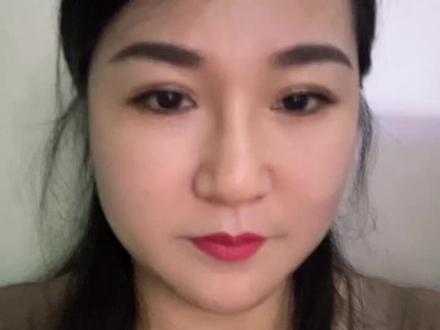 我为什么选择去do🐻
#假体#隆胸术后真实感受