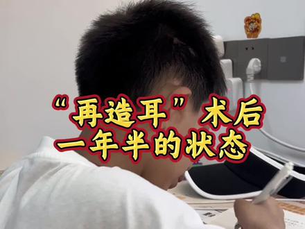 大家最关心的术后恢复状态#耳再造