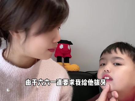 拔牙绳儿系法!猪鼻打结法 嘎嘎好使,一拽就下来!
(在家拔牙一定要牙马上掉下来呼之欲出的时候,快准狠 孩子牙齿松动十多天了,我才下手的,要感受一下新牙是不是长出来了,切记不可轻举妄动啊!!#乳牙换牙 #拔牙 #拔牙绳结