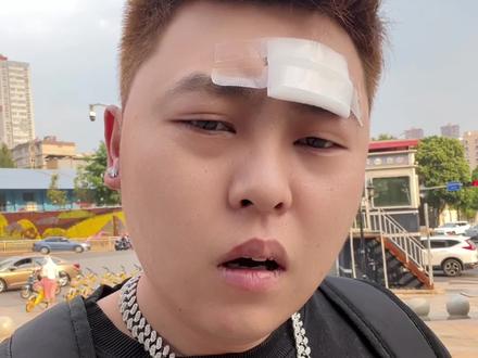 公分石是真呢疼#云南方言